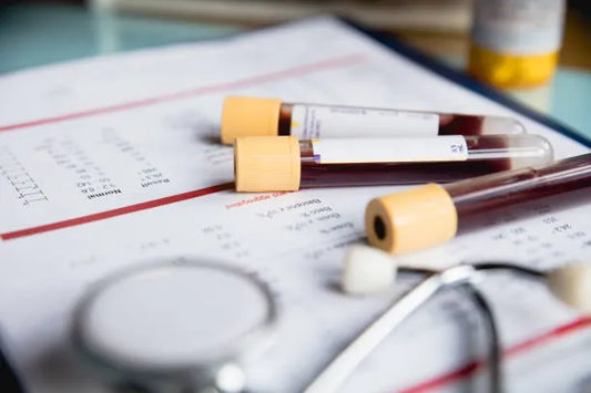 Blood vials and health charts—illustrating the vital role of testosterone in men’s health, vitality, and hormonal balance.